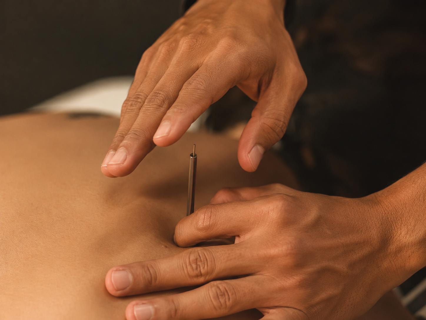 Aplicação de acupuntura japonesa
